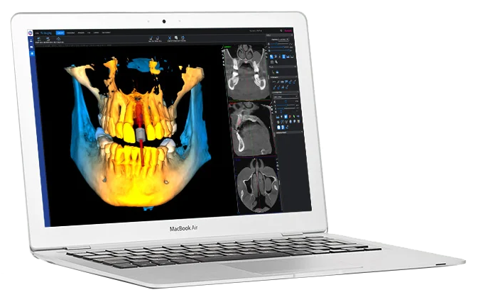 نمایی از Planmeca Romexis Viewer